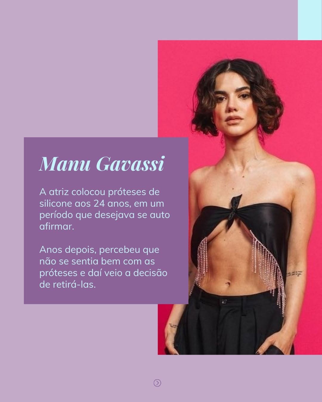 Tudo sobre explante - celebridades brasileira